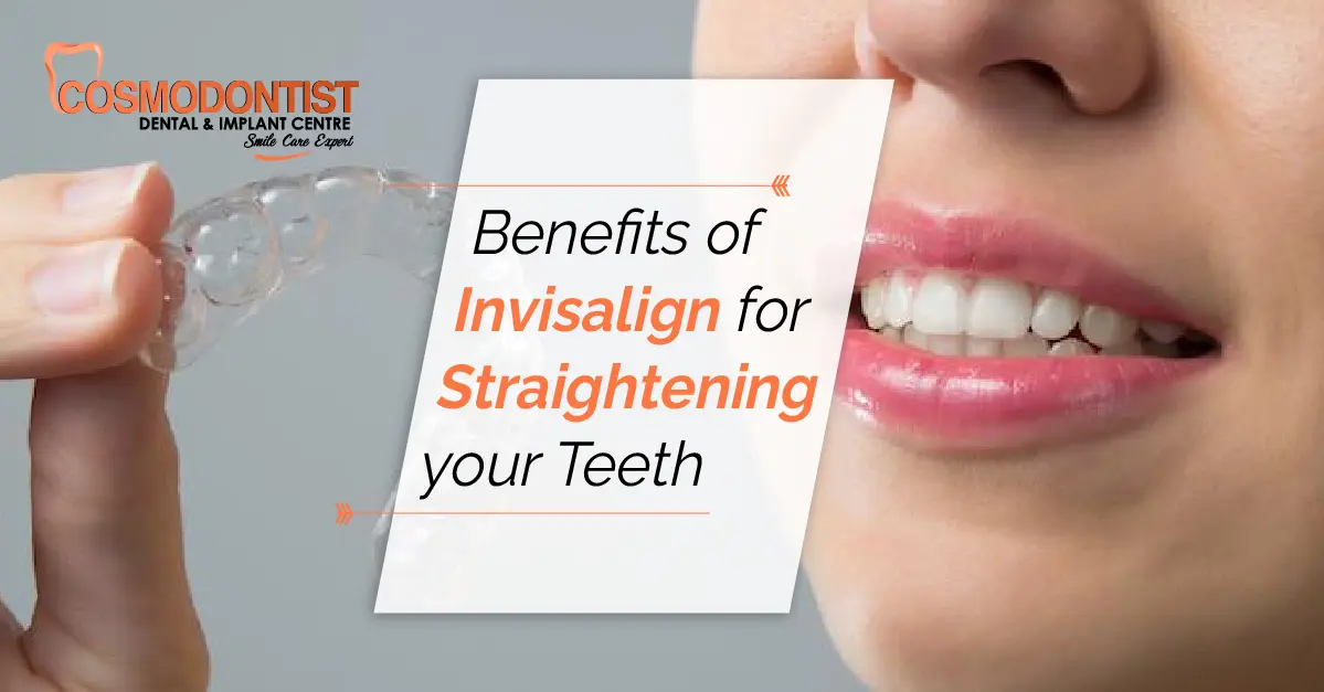 Benefits of Invisalign for Straightening Your Teeth