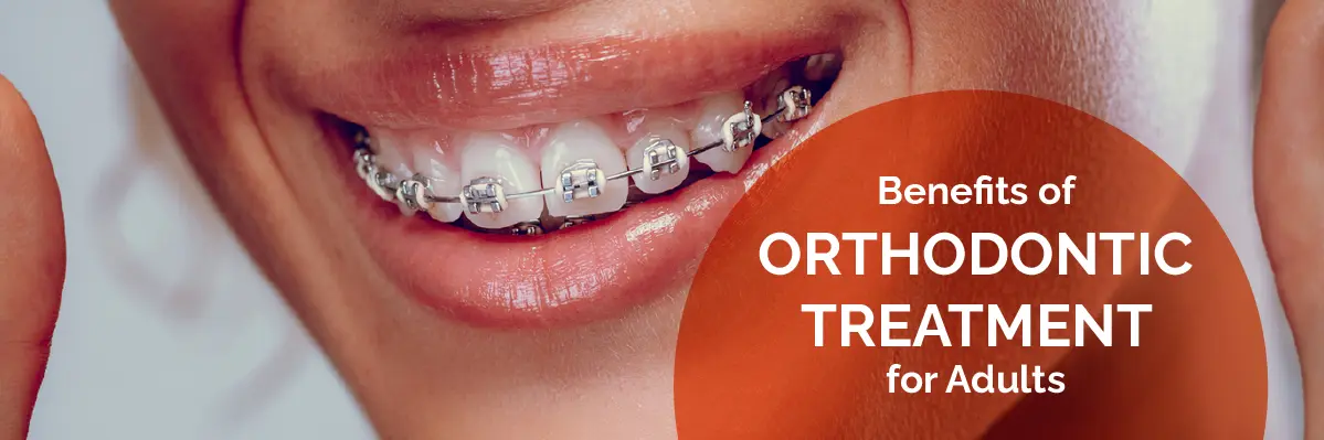 Invisalign Initial Consultation