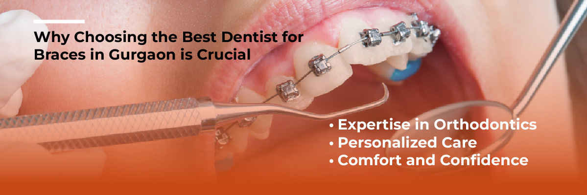 Invisalign Initial Consultation