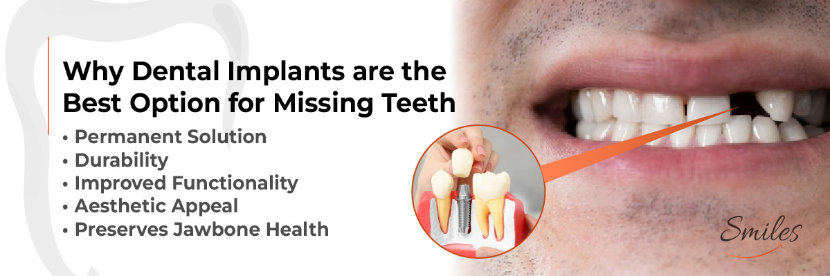 Invisalign Initial Consultation