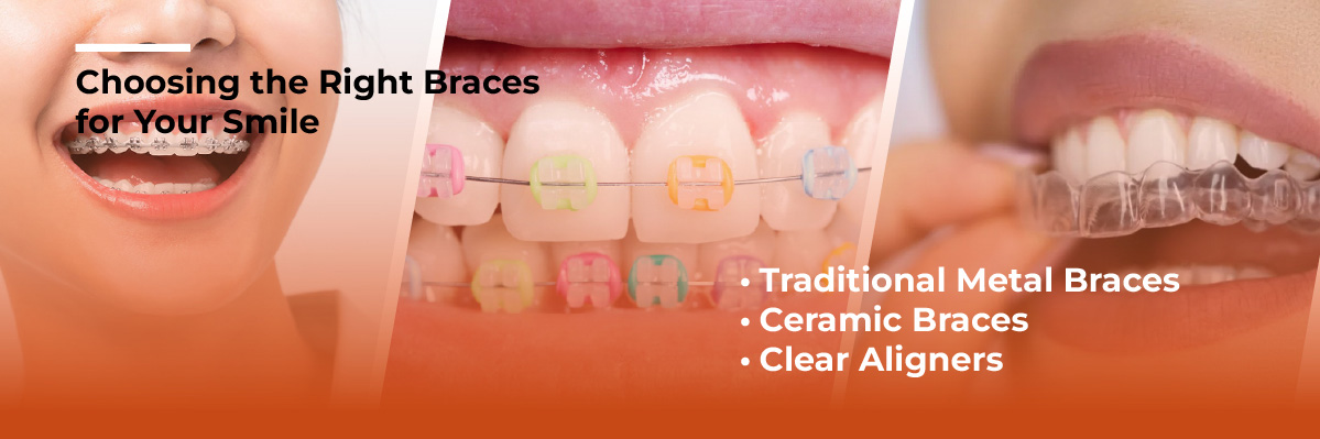 Invisalign Initial Consultation