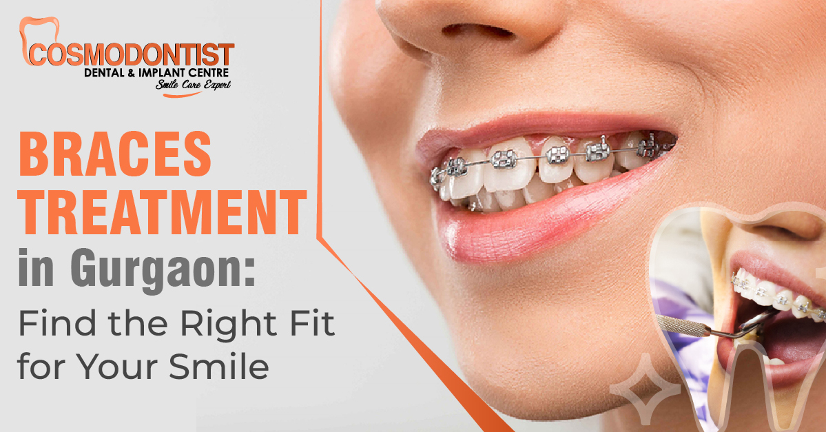 Braces Treatment in Gurgaon: Find the Right Fit for Your Smile