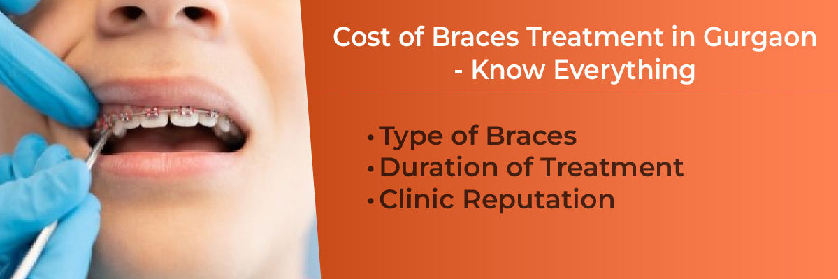 Braces Treatment in Gurgaon