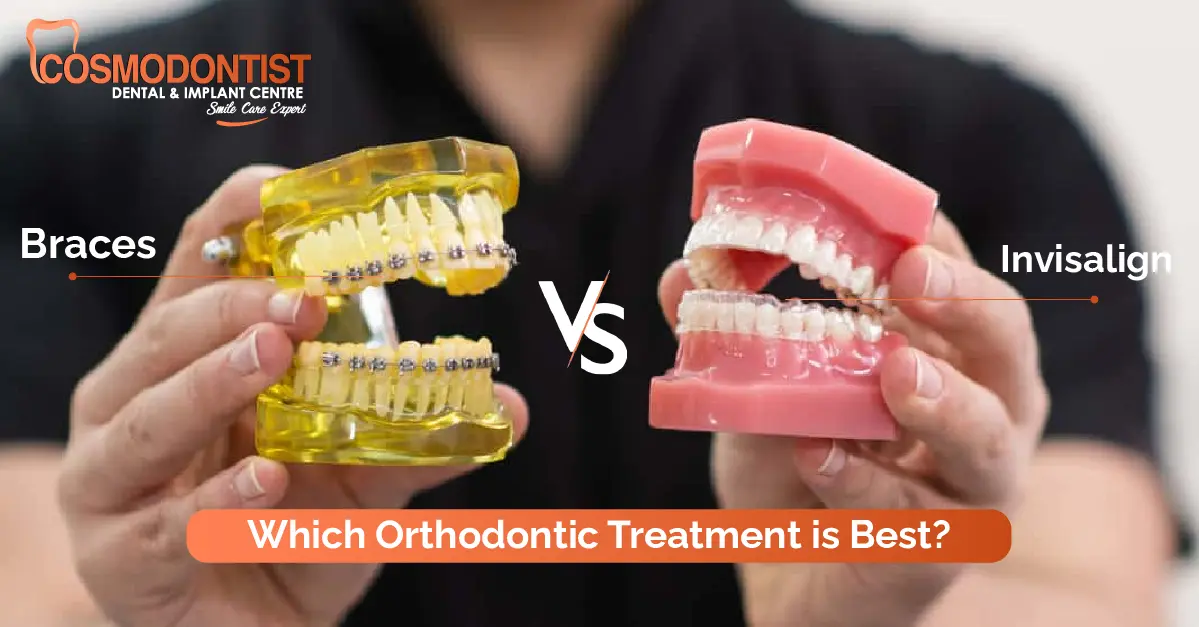 Braces Vs. Invisalign: Which Orthodontic Treatment is Best?