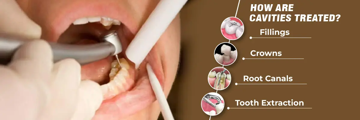 Invisalign Initial Consultation