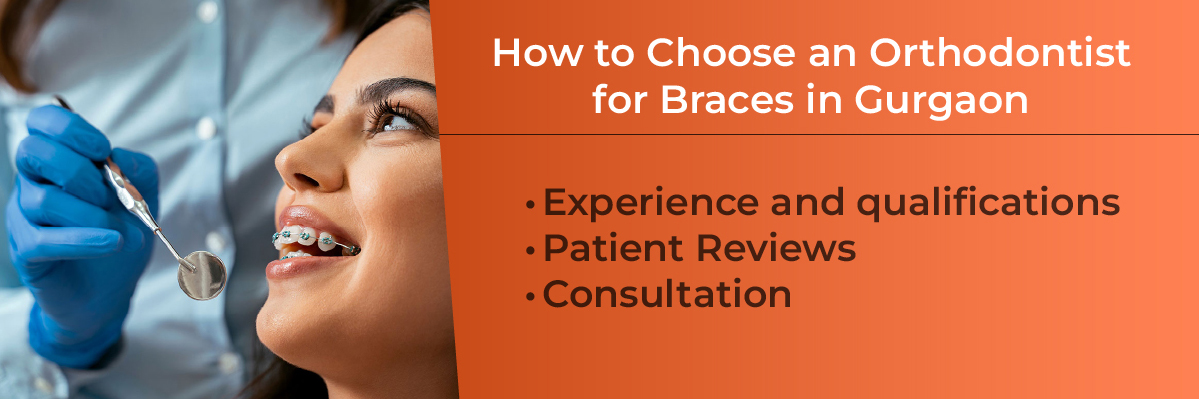 Invisalign Initial Consultation