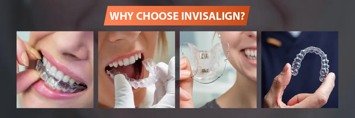 Invisalign Initial Consultation