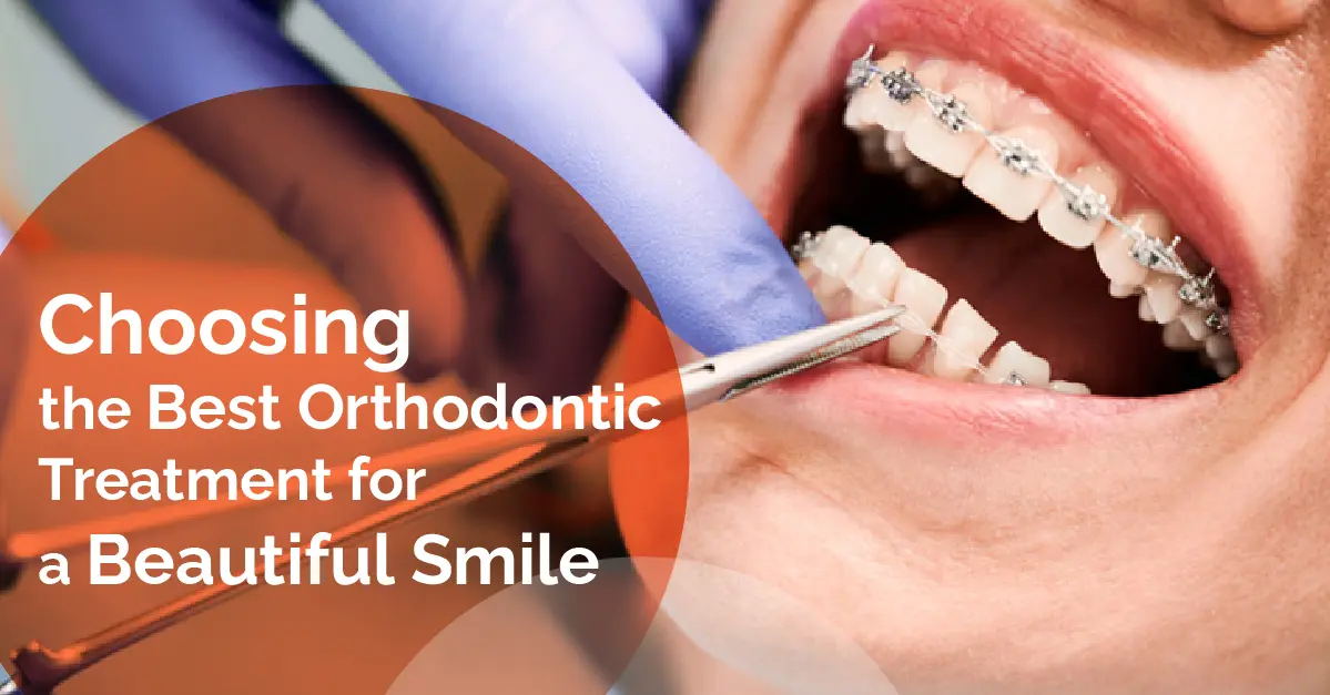 Choosing the Best Orthodontic Treatment for a Beautiful Smile
