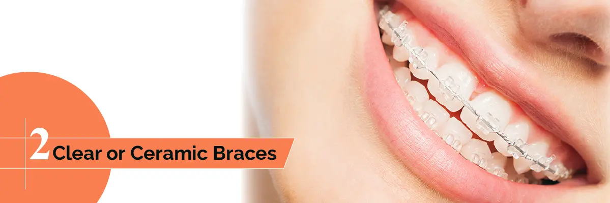 Invisalign Initial Consultation