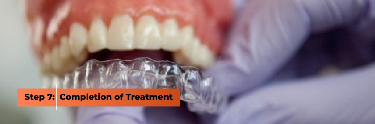 Completion of Invisalign Treatment