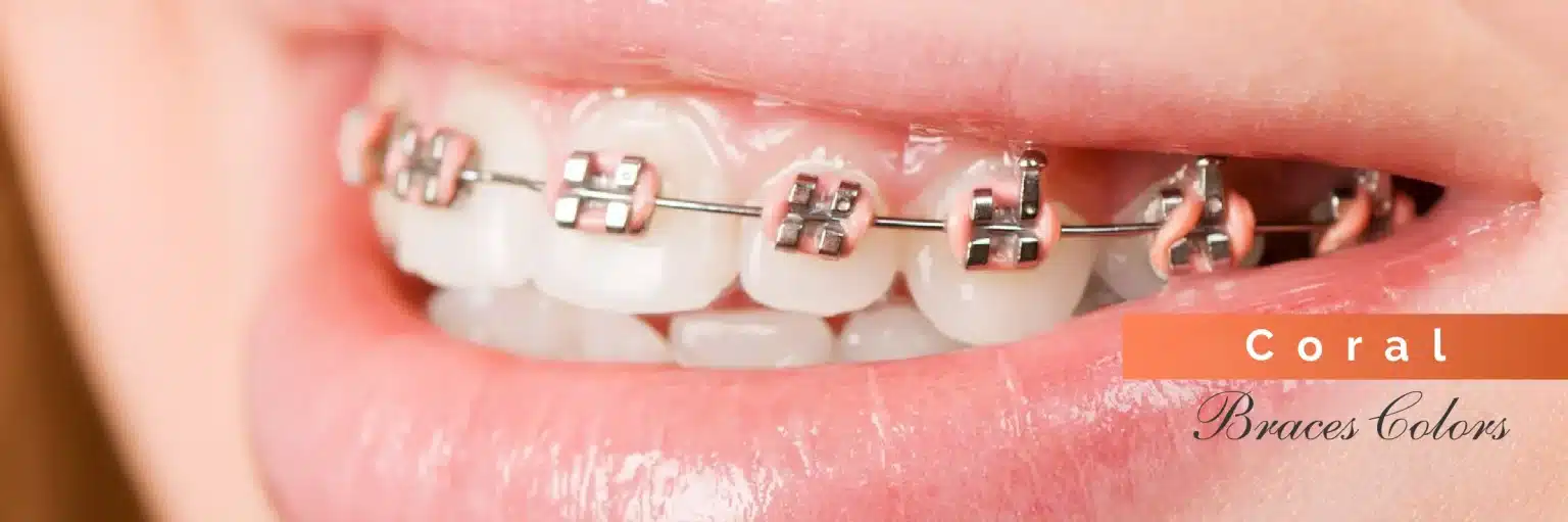 Invisalign Initial Consultation