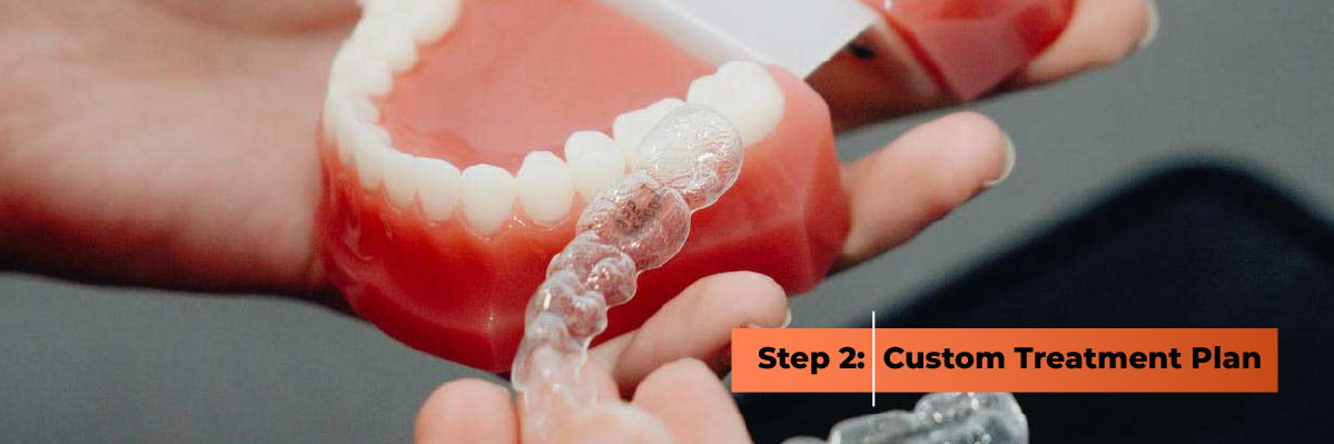 Custom Invisalign Treatment Plan