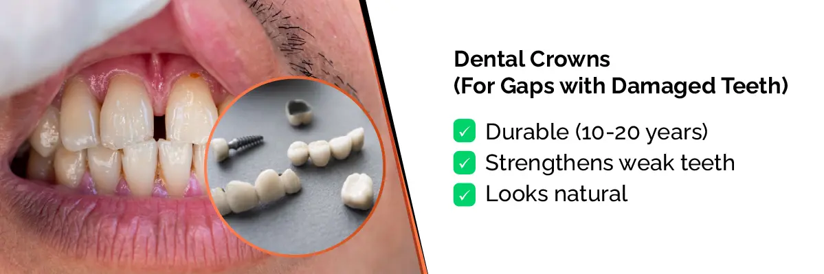 Invisalign Initial Consultation