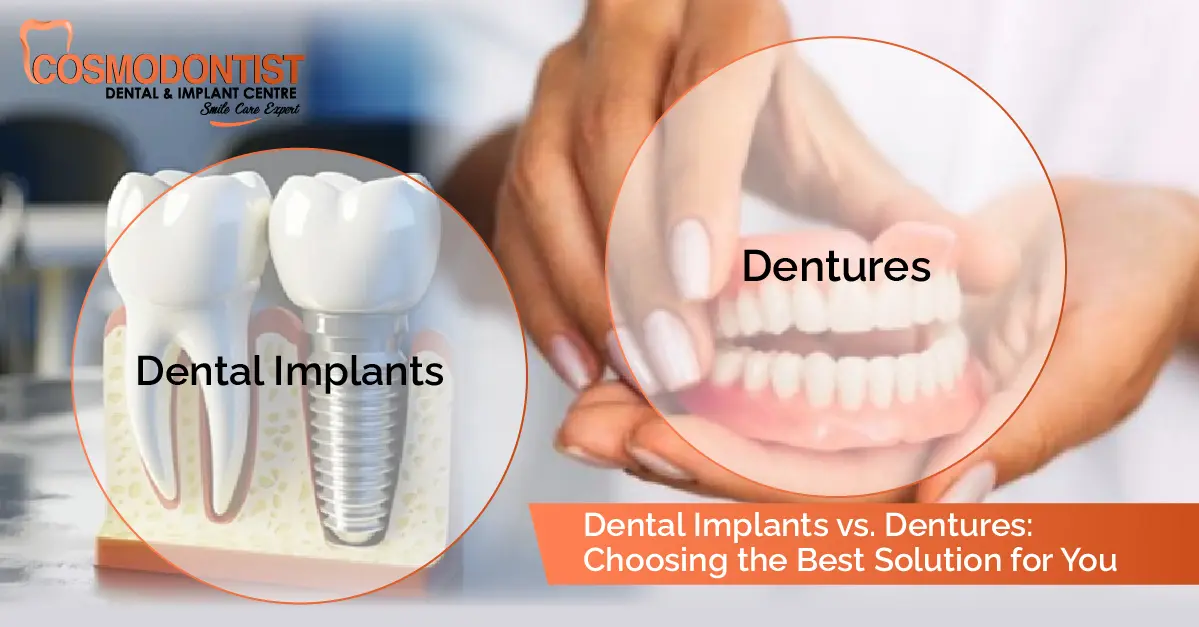 Dental Implants vs. Dentures: Choosing the Best Solution for You