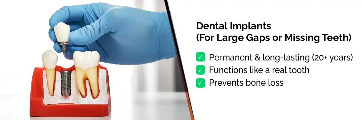 Invisalign Initial Consultation