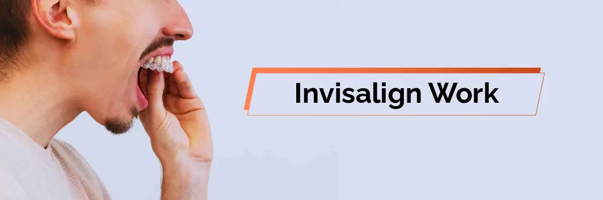 Invisalign Initial Consultation