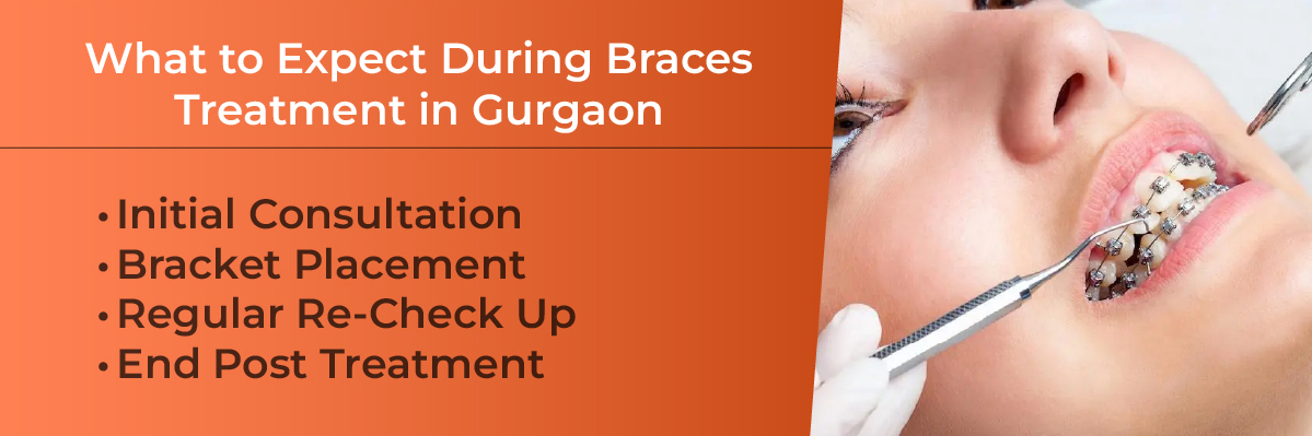 Invisalign Initial Consultation