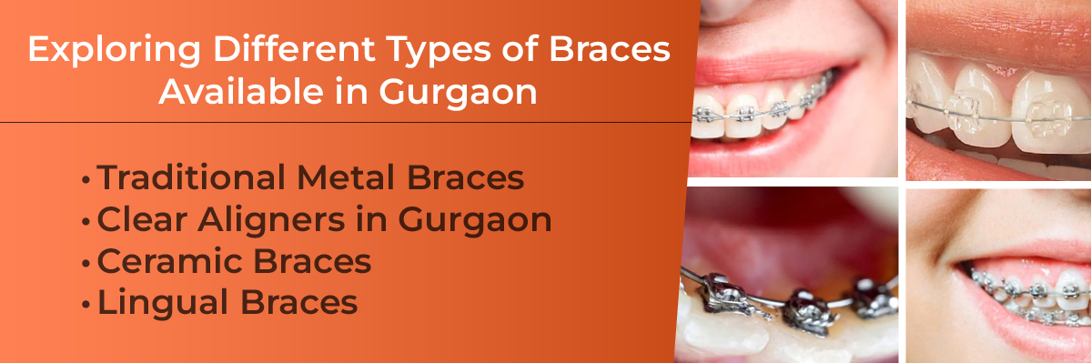 Invisalign Initial Consultation