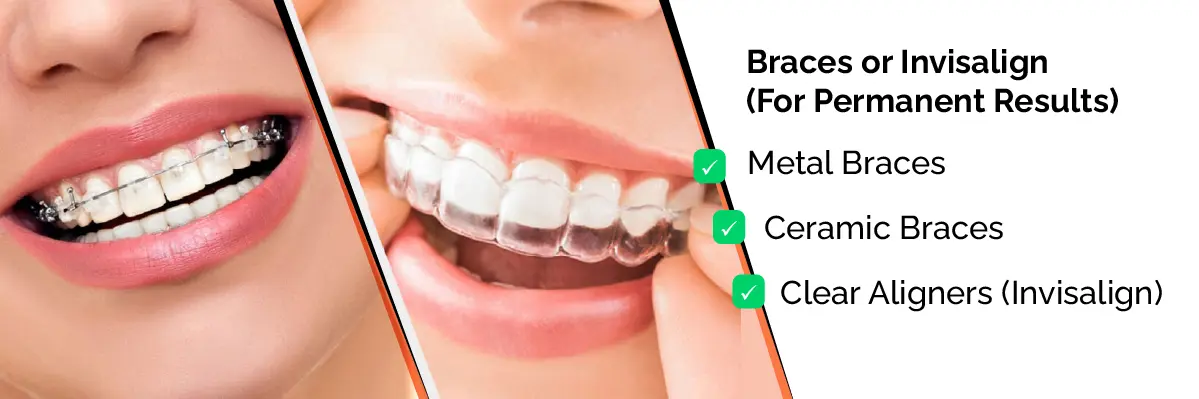 Invisalign Initial Consultation