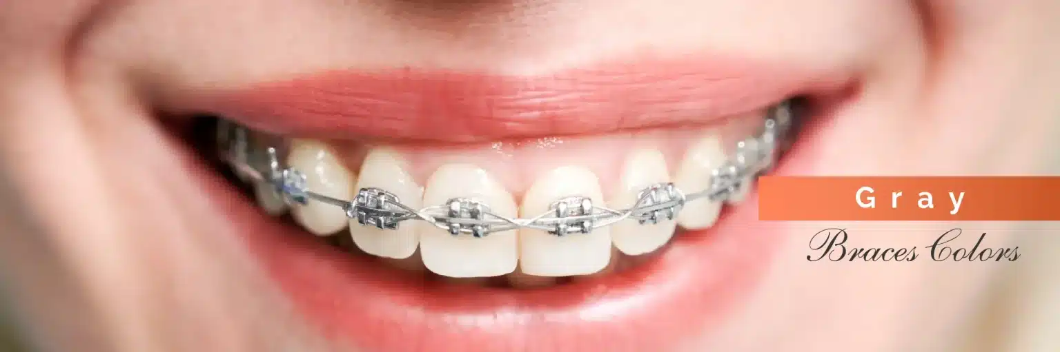 Invisalign Initial Consultation