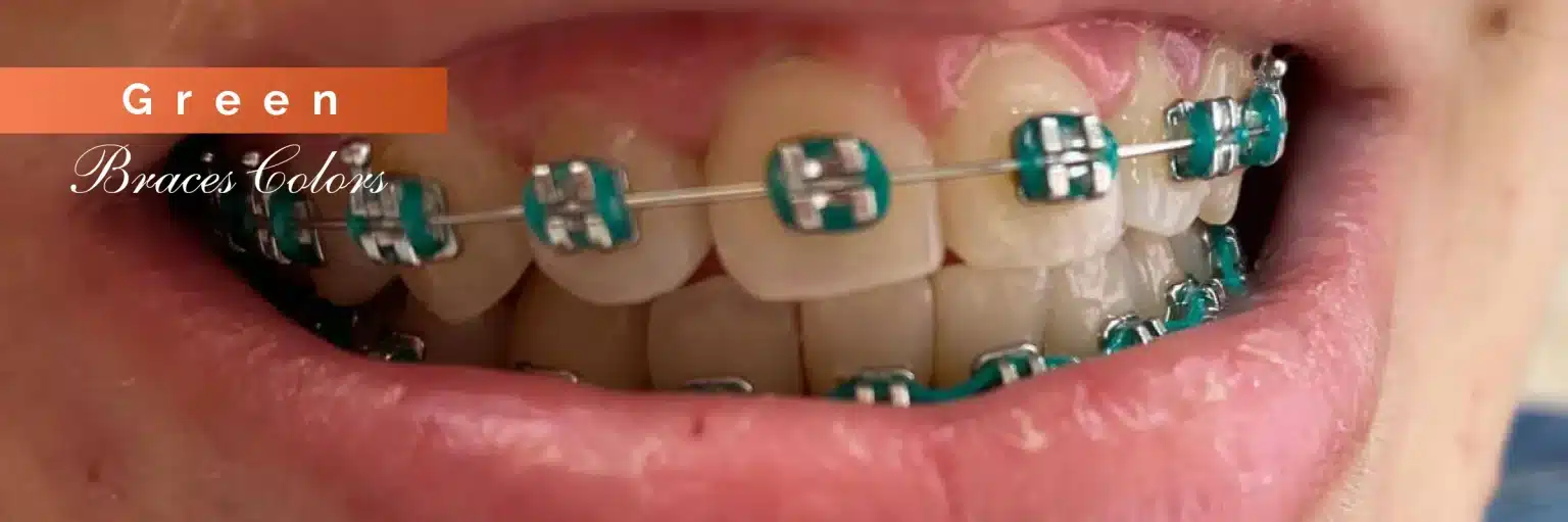 Invisalign Initial Consultation