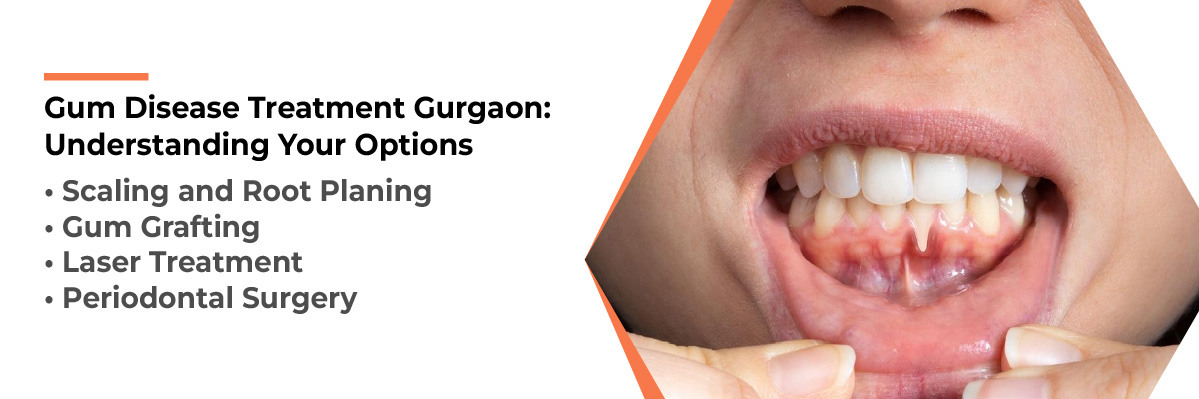 Invisalign Initial Consultation