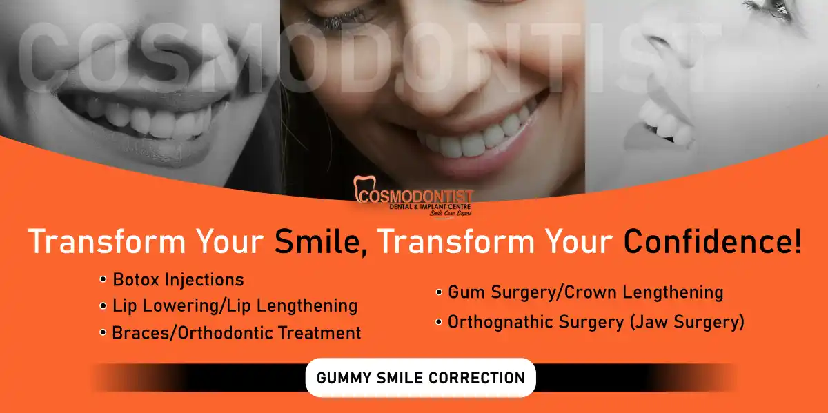 Gummy Smile Correction: Causes And Treatment