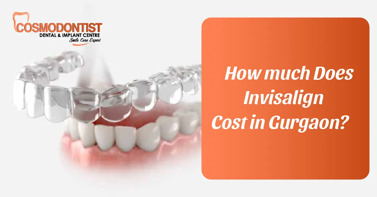 How Much Does Invisalign Cost in Gurgaon?