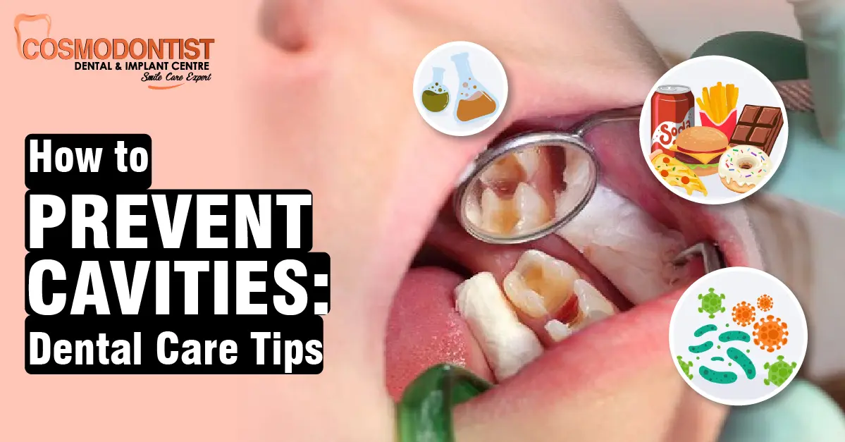 How to Prevent Cavities: Dental Care Tips