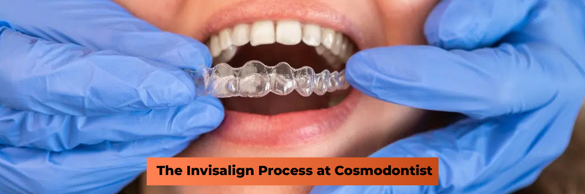 Invisalign Initial Consultation