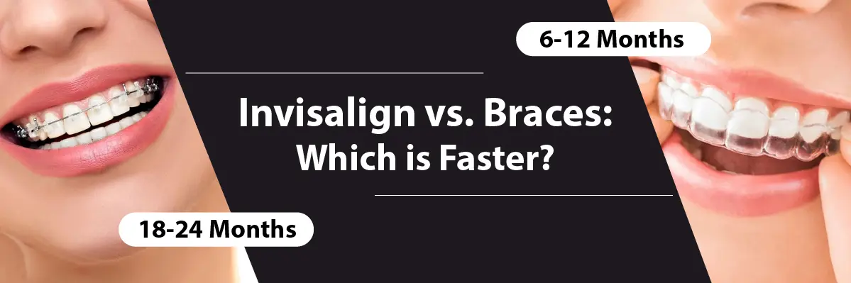 Invisalign Initial Consultation