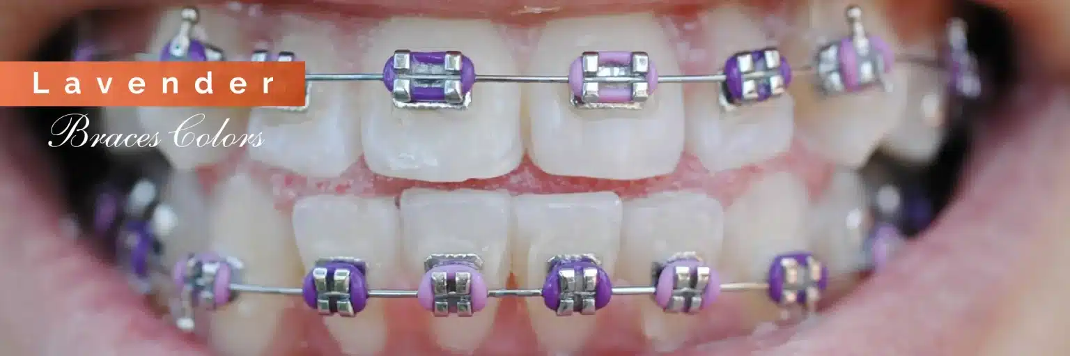 Invisalign Initial Consultation