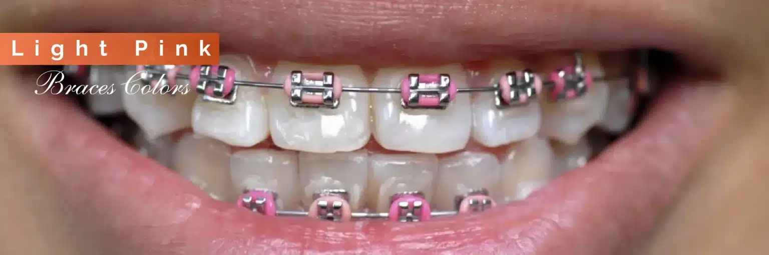 Invisalign Initial Consultation