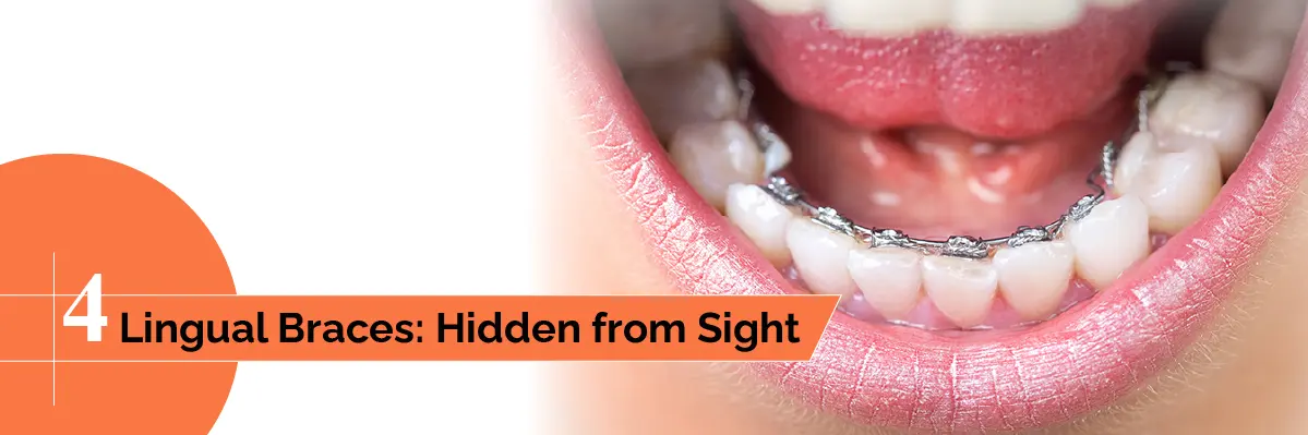 Invisalign Initial Consultation