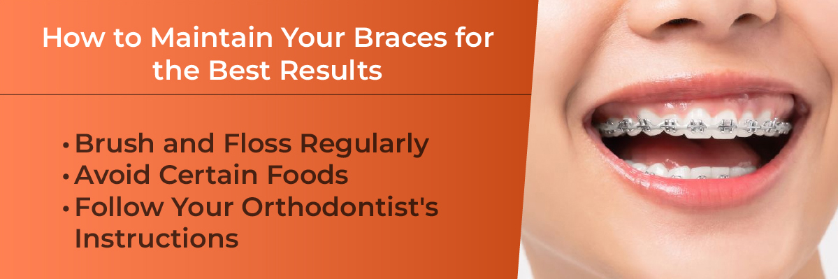 Invisalign Initial Consultation