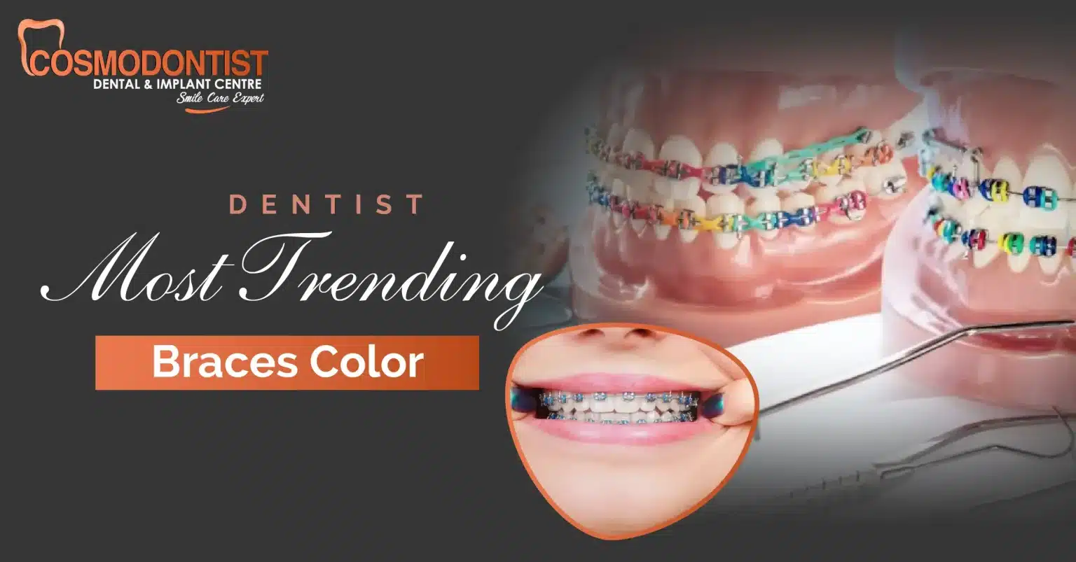 Most Trending Braces Color