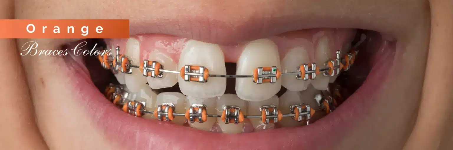 Invisalign Initial Consultation