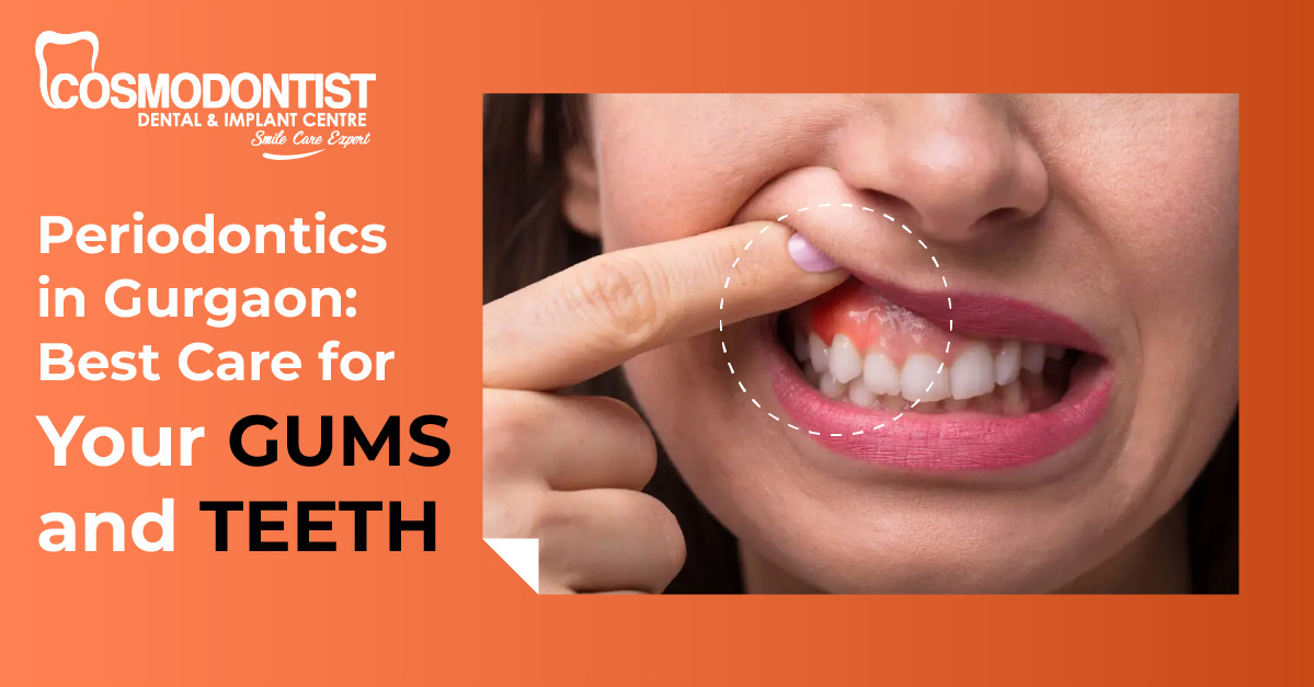 Periodontics in Gurgaon: Best Care for Your Gums and Teeth