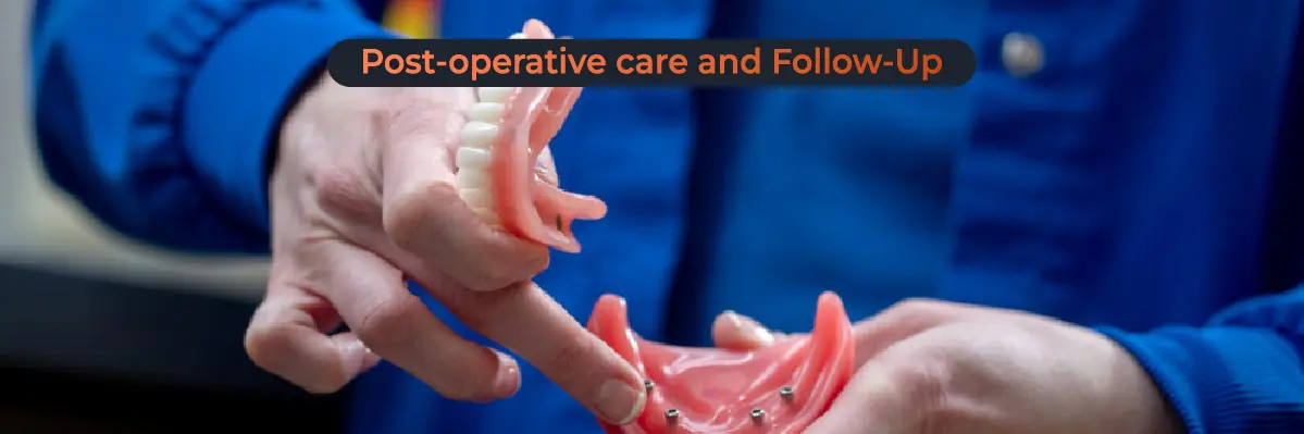 Invisalign Initial Consultation