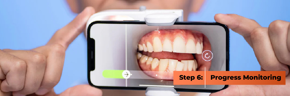 Invisalign Progress Monitoring