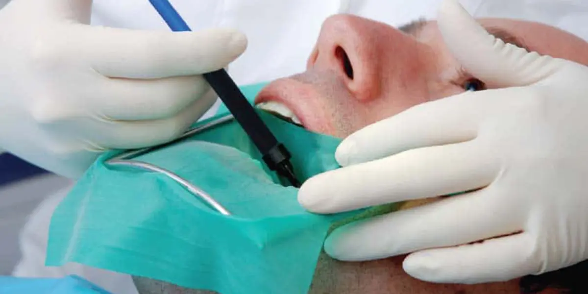 Causes Of Pain after Root Canal Treatment