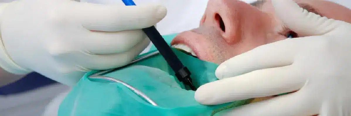 Causes Of Pain after Root Canal Treatment