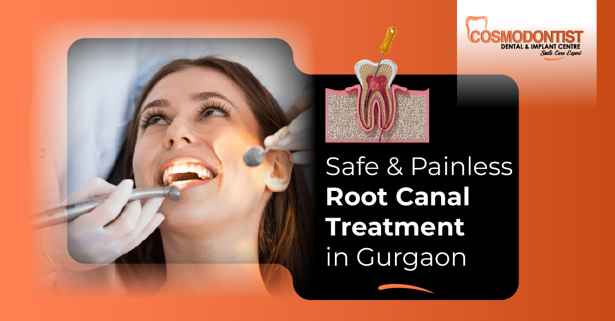 Safe & Painless Root Canal Treatment in Gurgaon