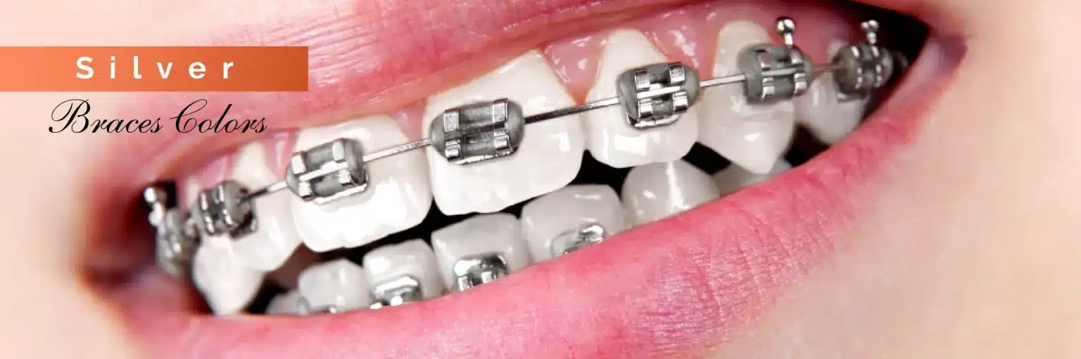 Invisalign Initial Consultation