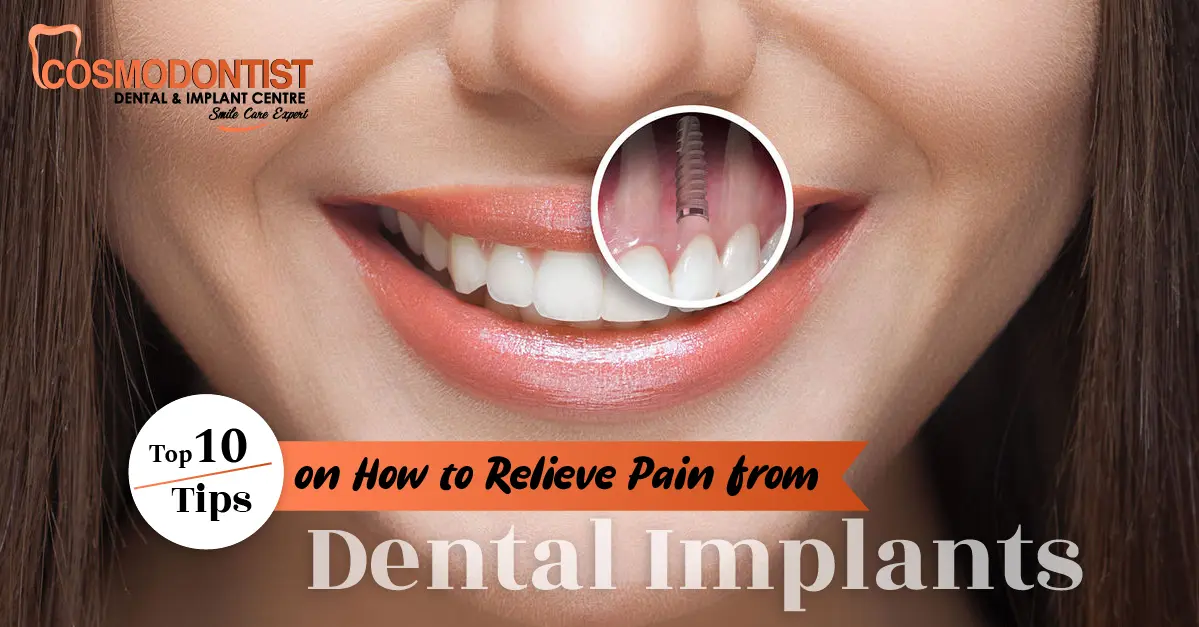 Top 10 Tips on How to Relieve Pain from Dental Implants