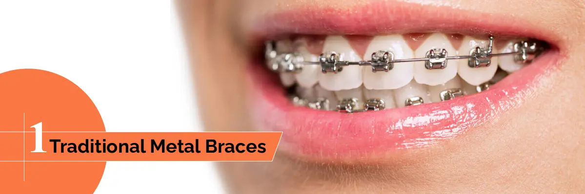 Invisalign Initial Consultation