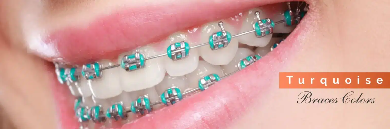 Invisalign Initial Consultation