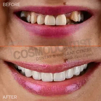 cosmetic