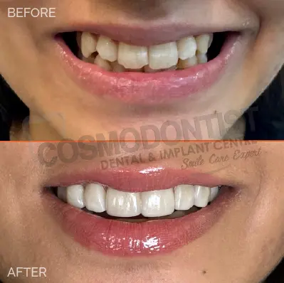 before treatment