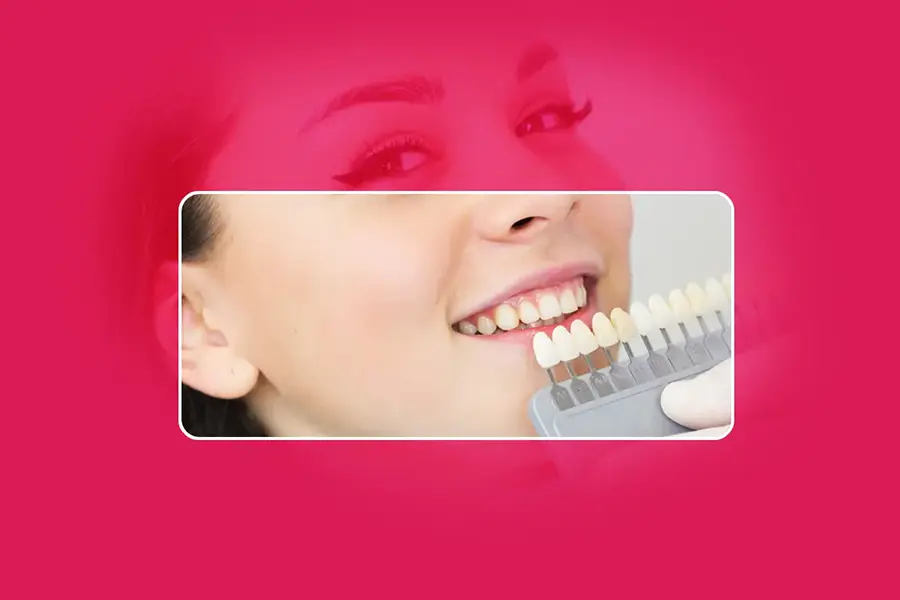 Cosmetic Dental Treatment